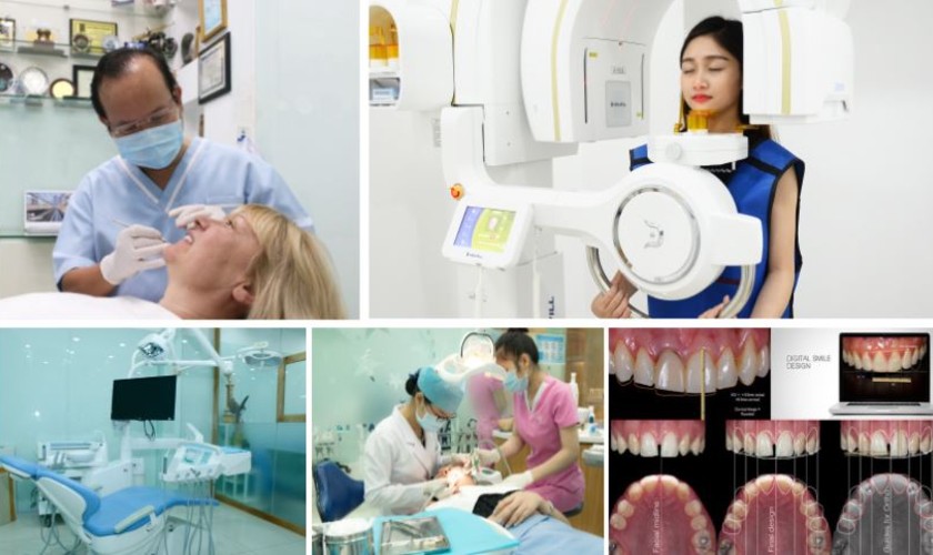Cấy ghép Implant tại nha khoa Nhân Tâm