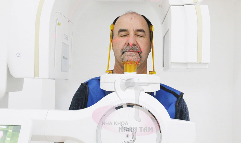 Chụp phim CT Cone Beam 3D để khảo sát răng và bề mặt xương