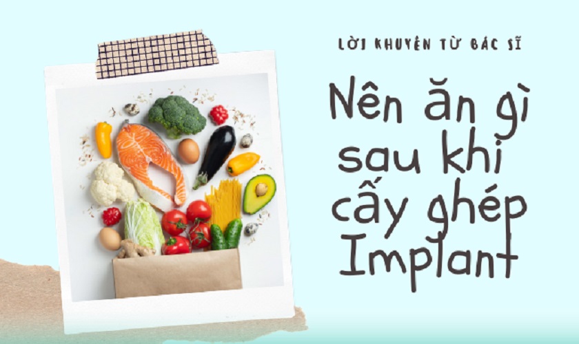 10. Kết luận & khuyến nghị