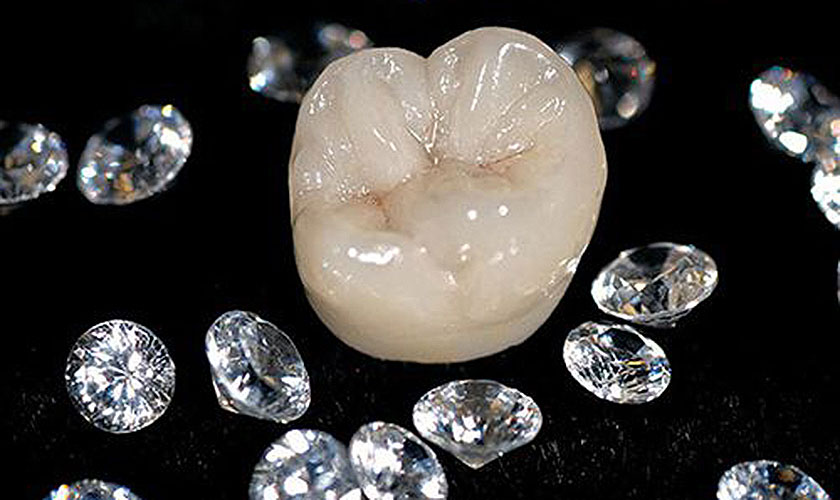 Ưu điểm răng sứ Cercon và Zirconia là cứng chắc, bền và độ thẩm mỹ cao