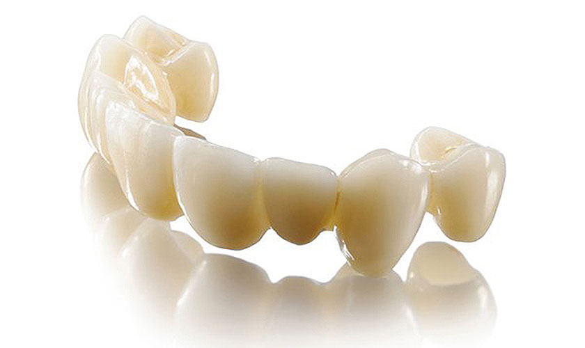 Hãy liên hệ nha khoa Nhân Tâm để được các chuyên gia giúp bạn chọn răng sứ Cercon hay Zirconia