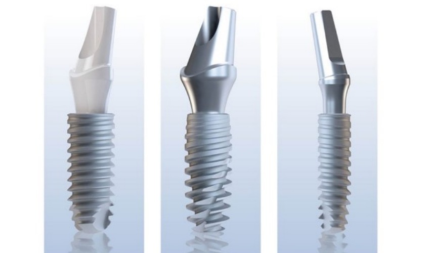 Implant Anthogy – thương hiệu implant Pháp nổi tiếng thế giới