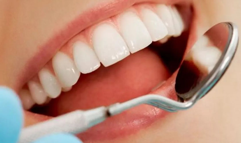 So sánh ưu - nhược điểm của răng sứ Cercon và Zirconia