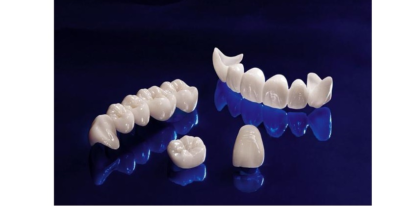 Răng sứ Zirconia có nhiều ưu điểm vượt trội hơn so với răng sứ Cercon