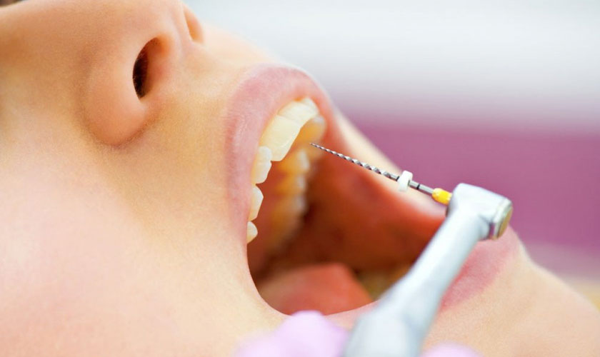 Nguyên nhân và cách điều trị đau nhức răng cửa hiệu quả