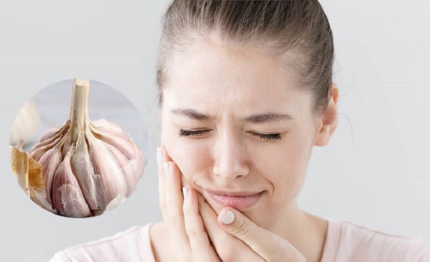 Chữa viêm chân răng bằng tỏi