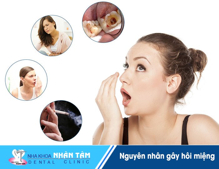 Các nguyên nhân gây hôi miệng