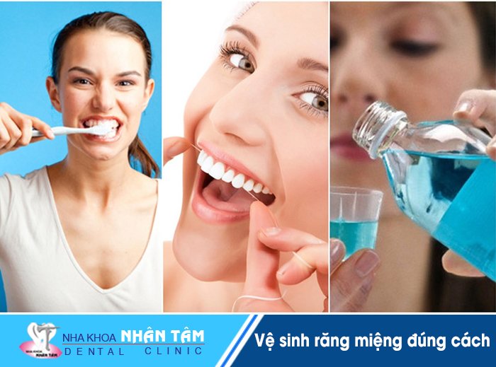 Vệ sinh răng miệng đúng cách
