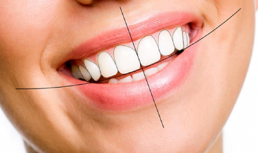 Răng sứ thẩm mỹ đáp ứng đầy đủ tiêu chuẩn thẩm mỹ hiện đại