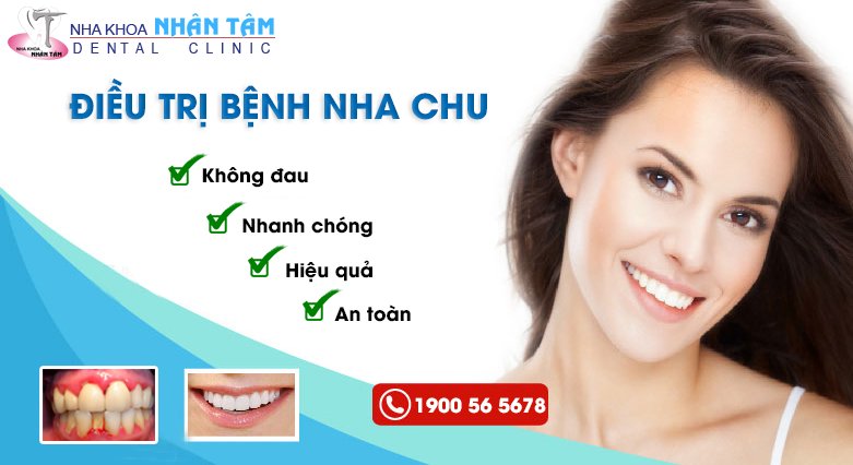 Điều trị bệnh viêm nha chu tại Nha khoa Nhân Tâm