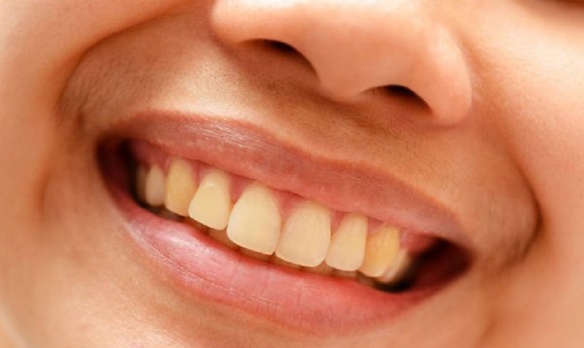 Bạn có thể sử dụng bàn chải đánh răng điện để làm gì cho răng hết ố vàng?
