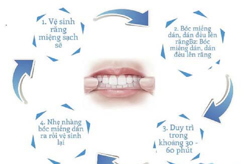 Cách sử dụng miếng dán tẩy trắng răng mau có hiệu quả