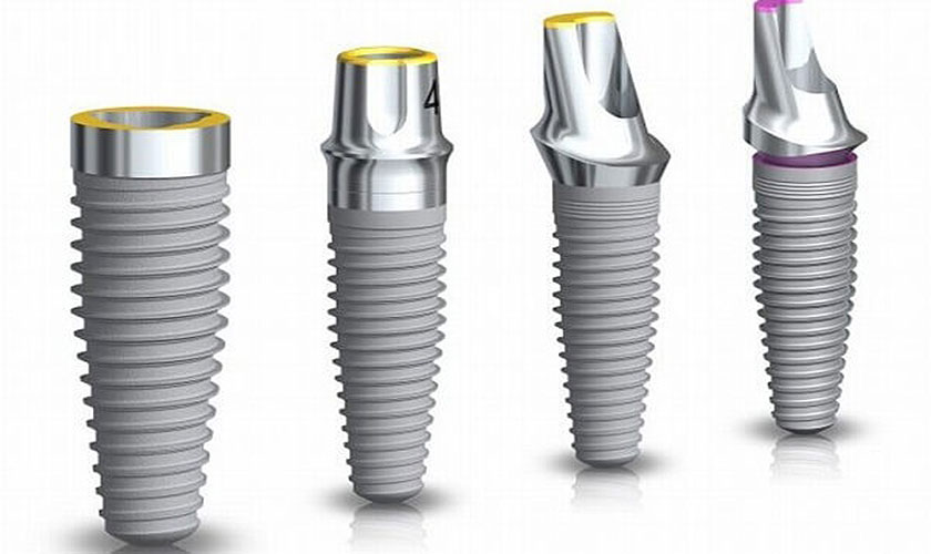 Giá cấy ghép Implant tức thì dao động tuỳ theo loại Implant sử dụng Giá cấy ghép Implant tức thì dao động tuỳ theo loại Implant sử dụng