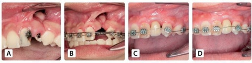 Công trình nghiên cứu của bác sĩ Việt Nam đã được công bố Quốc tế