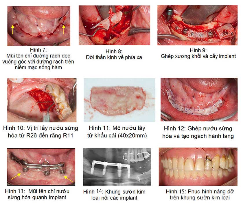 Giải pháp điều trị cho bệnh nhân