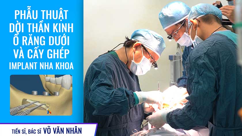 Ts.Bs Võ Văn Nhân thực hiện thành công kỹ thuật dời thần kinh để cấy ghép răng implant