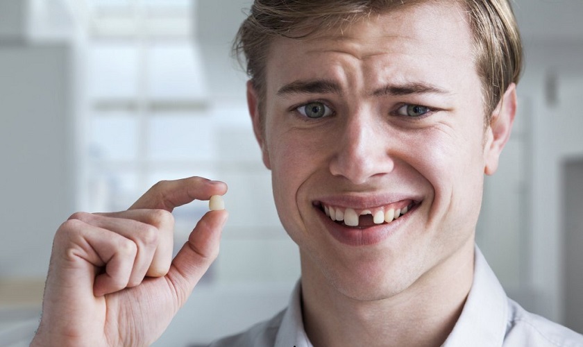 Những biểu hiện và triệu chứng của một răng cửa gãy?
