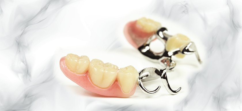 Hàm khung tháo lắp