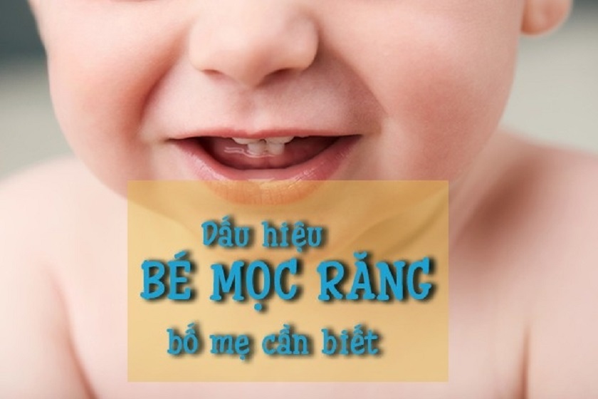 Sơ Đồ Mọc Răng Của Bé