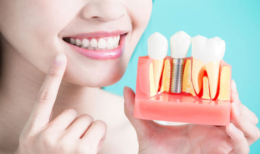 Nha khoa cấy ghép Implant an toàn và hiệu quả tại Sài Gòn?