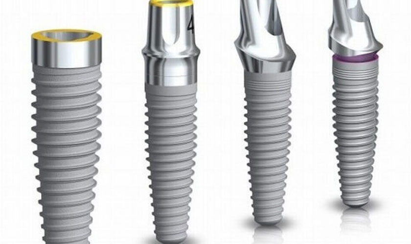Nha khoa Nhân Tâm có nhiều sự lựa chọn về phương pháp Implant nha khoa