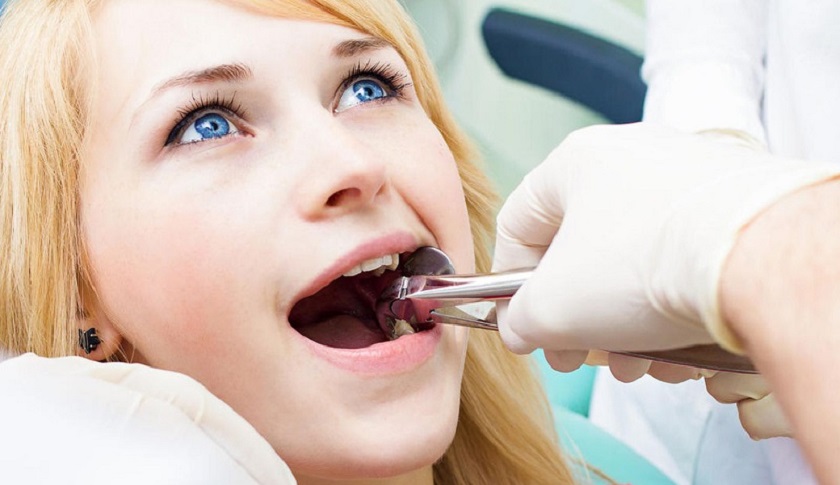 Giải đáp: “Nhổ răng có đau không?”