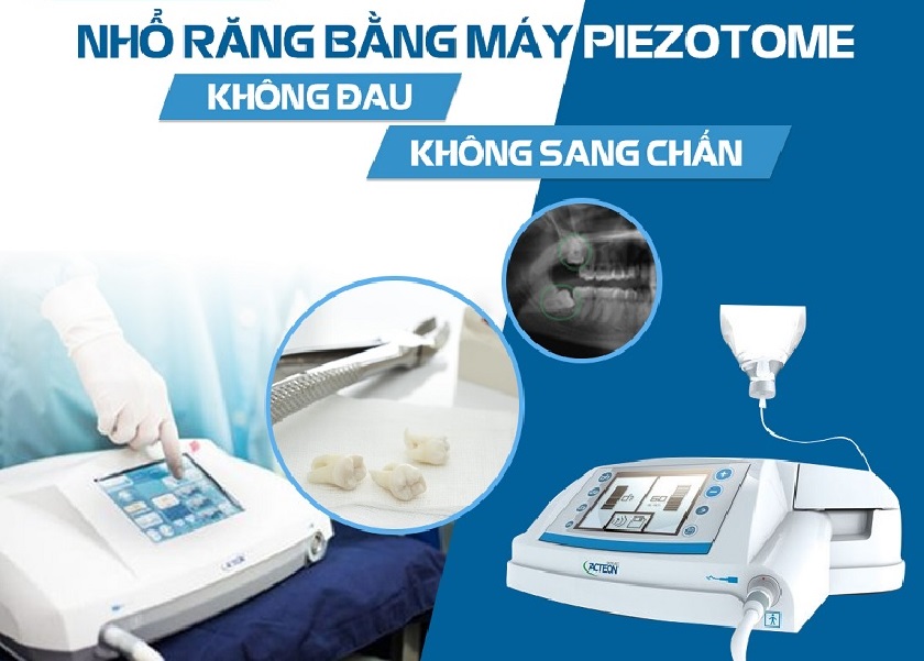 Tìm hiểu cách nhổ răng khôn bằng máy siêu âm Piezotome Tìm hiểu cách nhổ răng khôn bằng máy siêu âm Piezotome