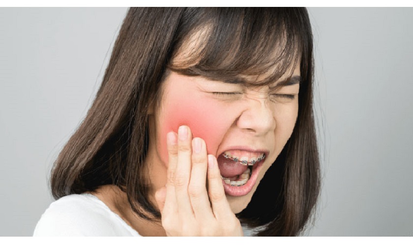 Cách khắc phục bị nhức răng hàm dưới sau khi lấy răng