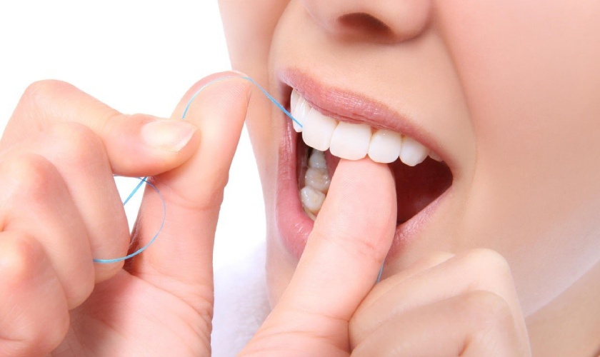 Cần vệ sinh răng miệng kỹ lưỡng sau khi dán răng sứ Veneer