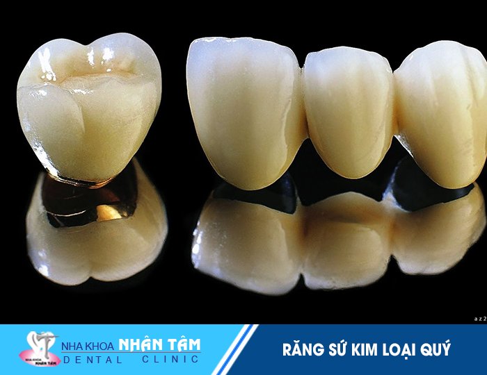 Răng sứ quý kim có những ưu điểm gì so với các loại răng sứ khác?
