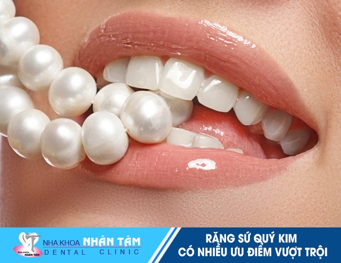 Răng sứ kim loại quý là gì?