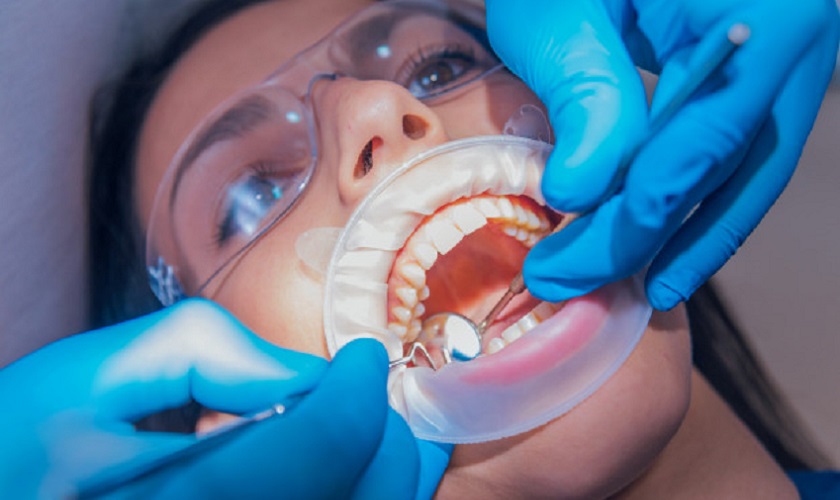 Trám răng lấy tủy giá bao nhiêu? Quy trình như thế nào?