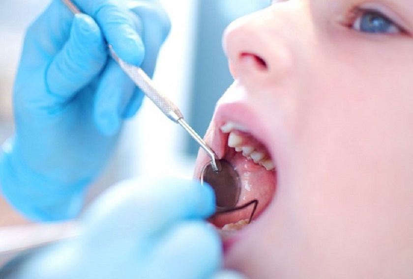 Sâu răng có dấu hiệu nhận biết như thế nào Sâu răng có dấu hiệu nhận biết như thế nào