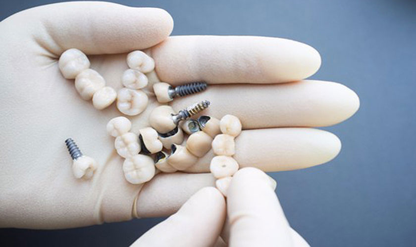 Khách hàng không cần lo lắng trồng răng Implant có an toàn không khi thực hiện tại nha khoa Nhân Tâm