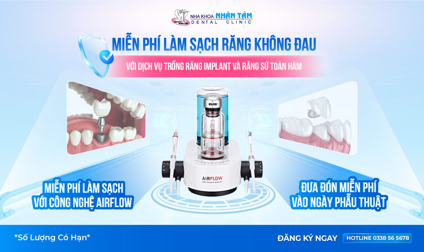 Ưu đãi trồng răng, răng sứ được tặng làm sạch răng không đau bằng Airflow