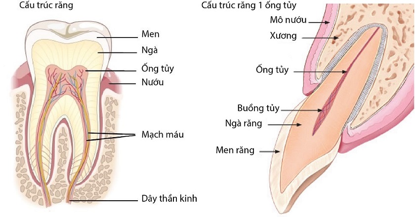 Bệnh viêm tủy răng