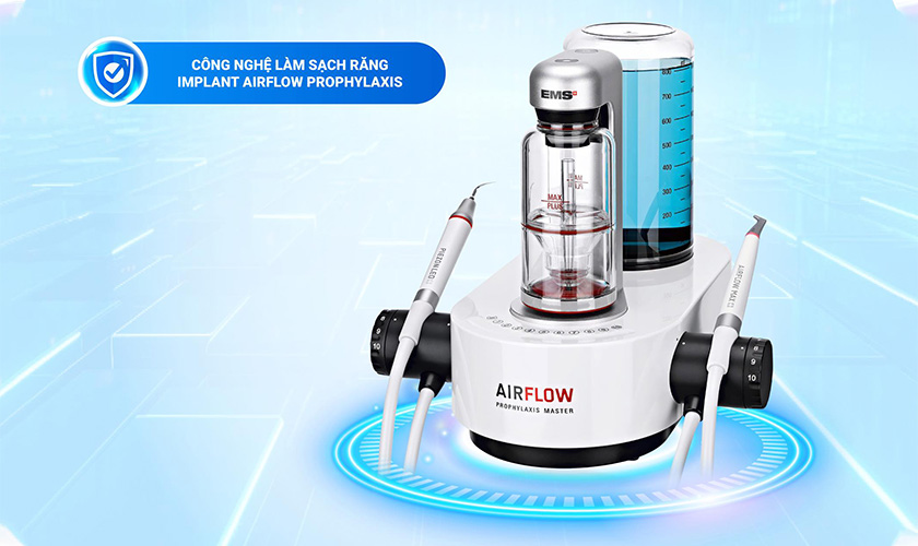 Công nghệ Guided Biofilm Therapy giúp loại bỏ mảng bám và vôi răng nhẹ nhàng, hiệu quả