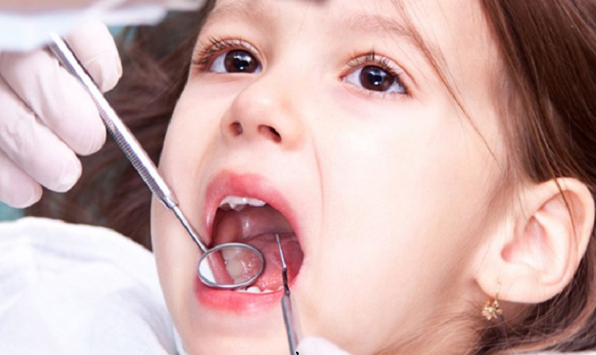 Viêm nha chu ở trẻ em có triệu chứng