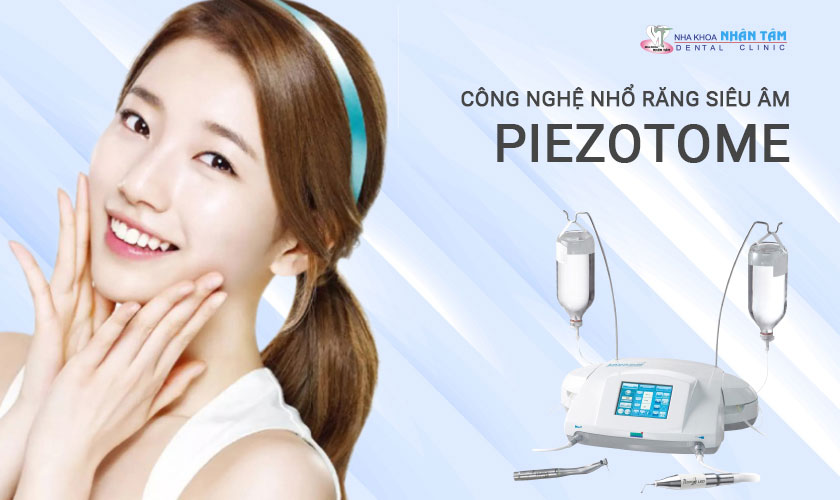 Nhổ răng khôn không đau với công nghệ siêu âm Piezotome tại nha khoa Nhân Tâm