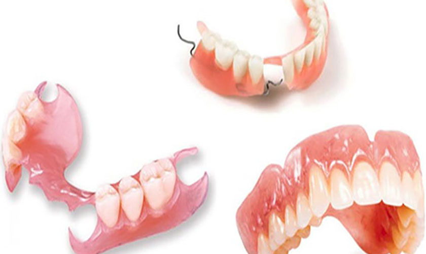 Điều trị mất răng bằng hàm giả tháo lắp
