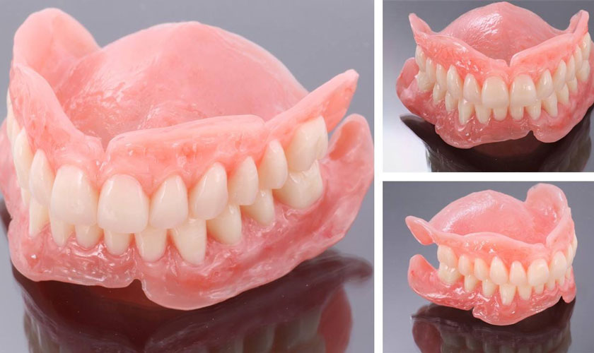 Hàm giả tháo lắp có chi phí rẻ và dễ dàng thực hiện