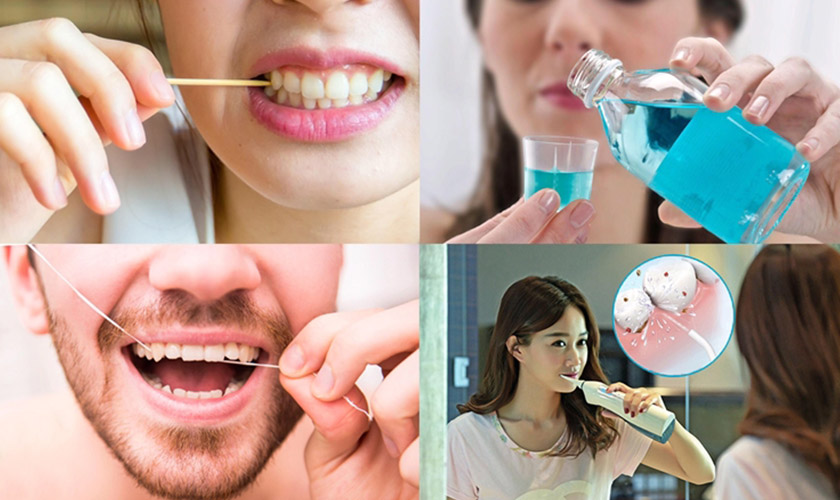 Chăm sóc răng sau khi bọc sứ