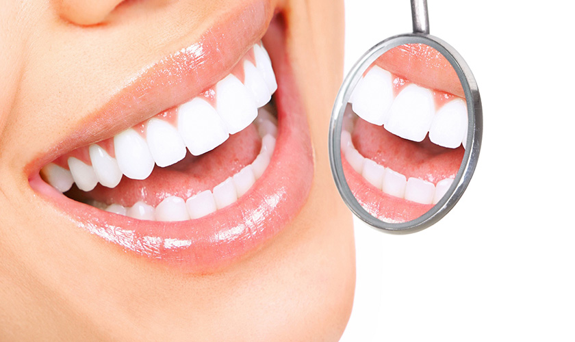 Răng sứ Cercon và những ưu điểm vượt trội