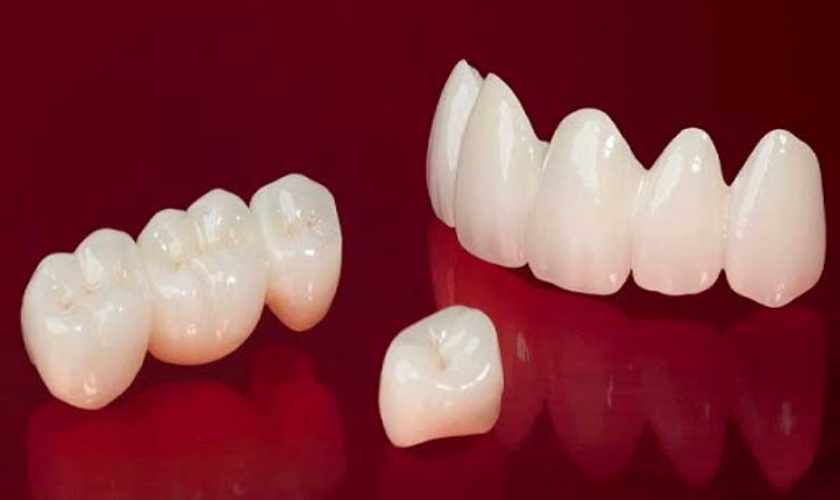 Nha khoa Nhân Tâm quy tụ đội ngũ bác sĩ giỏi, chuyên sâu trong lĩnh vực răng sứ thẩm mỹ