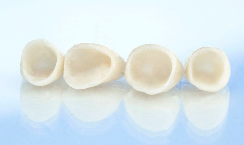 Răng toàn sứ đảm bảo an toàn cho sức khỏe