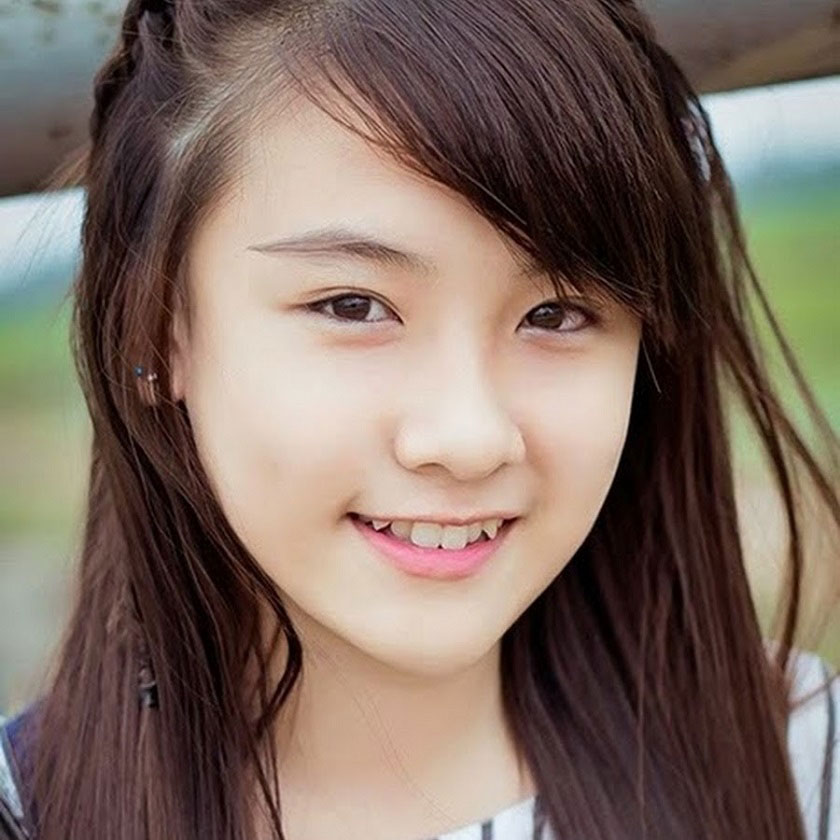 trong-rang-implant-gia-re-sai-gon