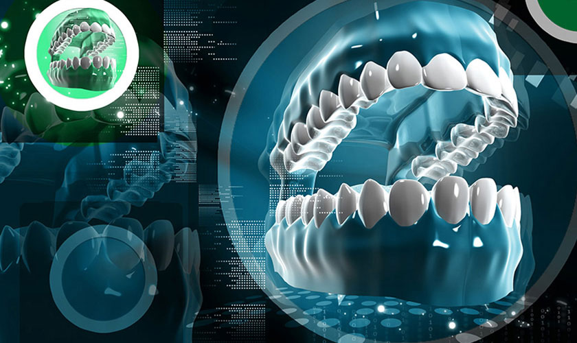 ứng dụng kỹ thuật CAD/CAM