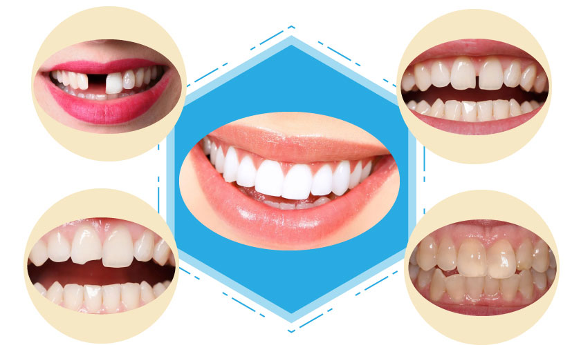 Giá làm răng sứ tại Nha khoa Nhân Tâm là bao nhiêu?