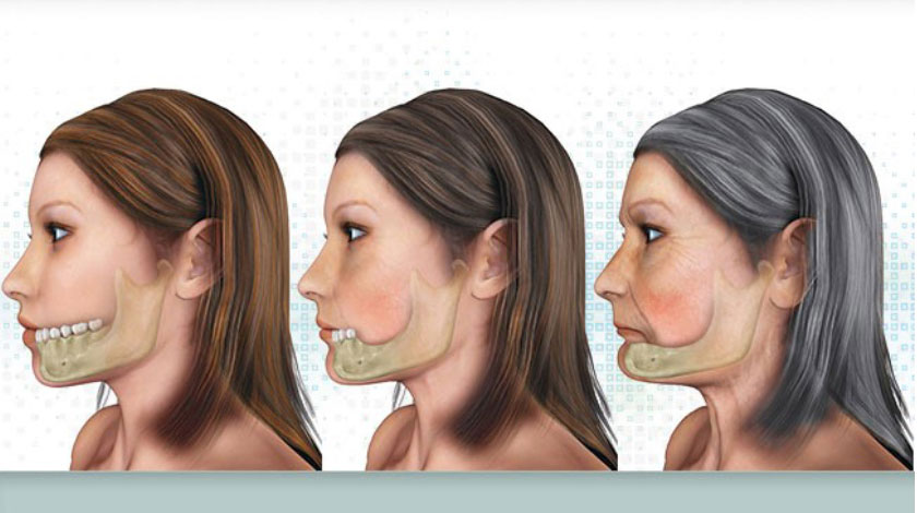 dich-vu-cay-ghep-implant-chat-luong-tai-quan-10