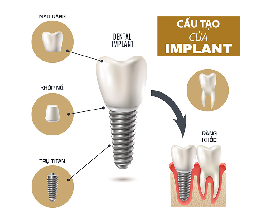 mat-rang-va-nhung-hau-qua-khon-luong